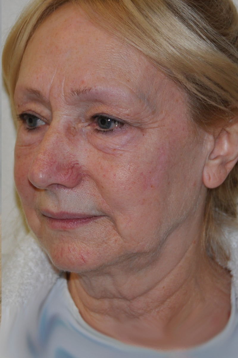 View 1 — before (pre-operative)